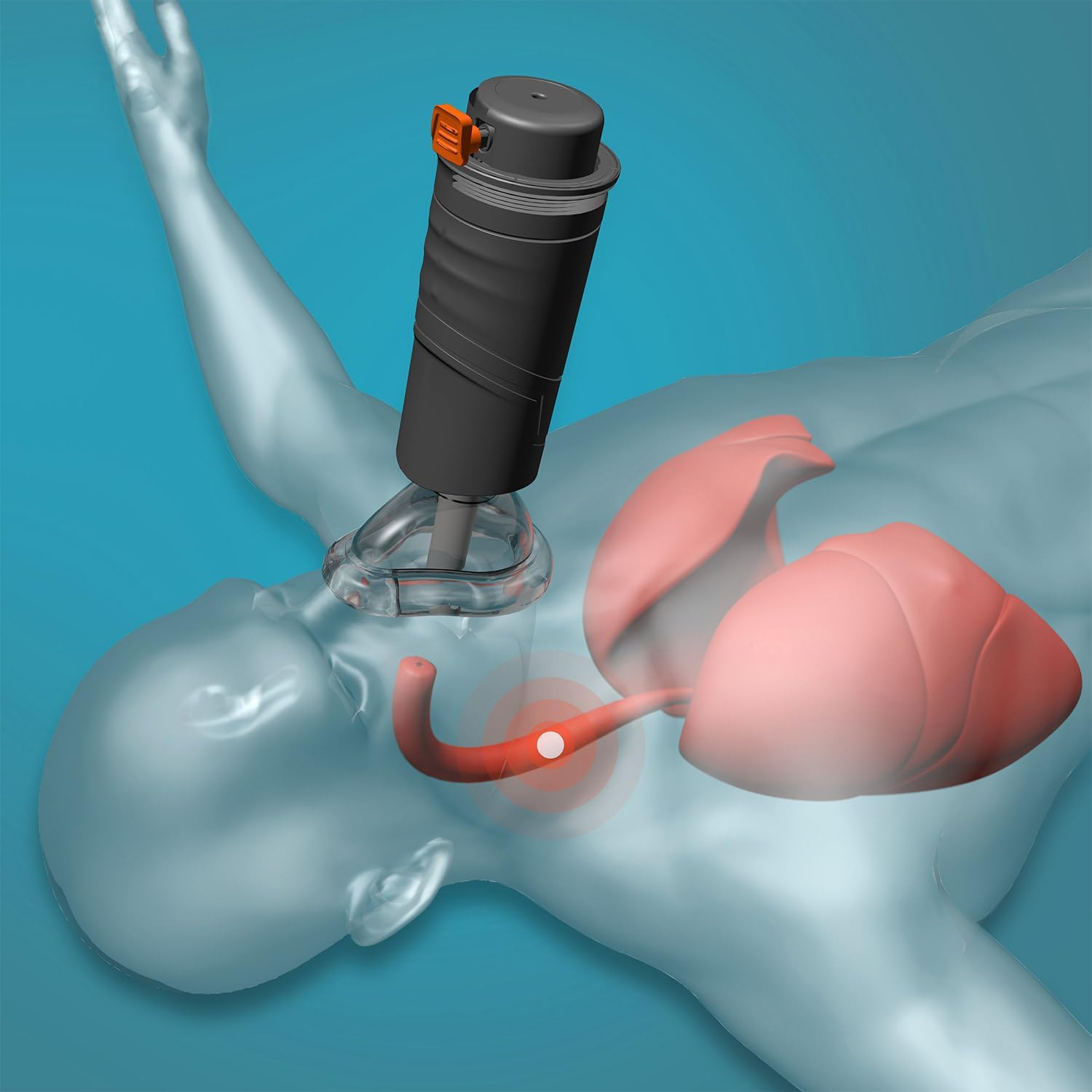 🔥Last Day 70% OFF🔥Adult And Child Anti Suffocation And Anti Choking Device