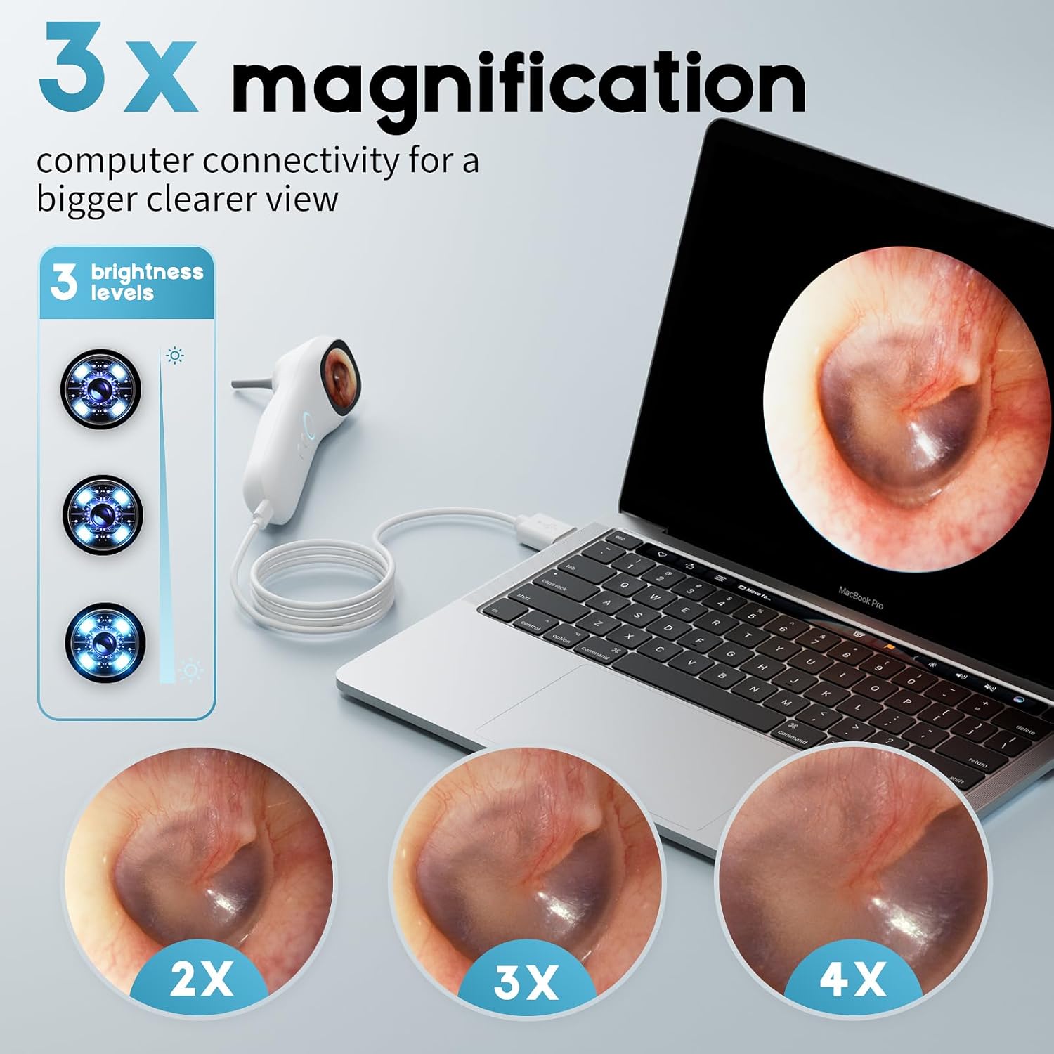 Otoscope Ear Camera with 1.21” Screen Earwax Removal Kit