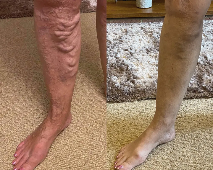 QIAWI&reg; Legs Soothing Cream