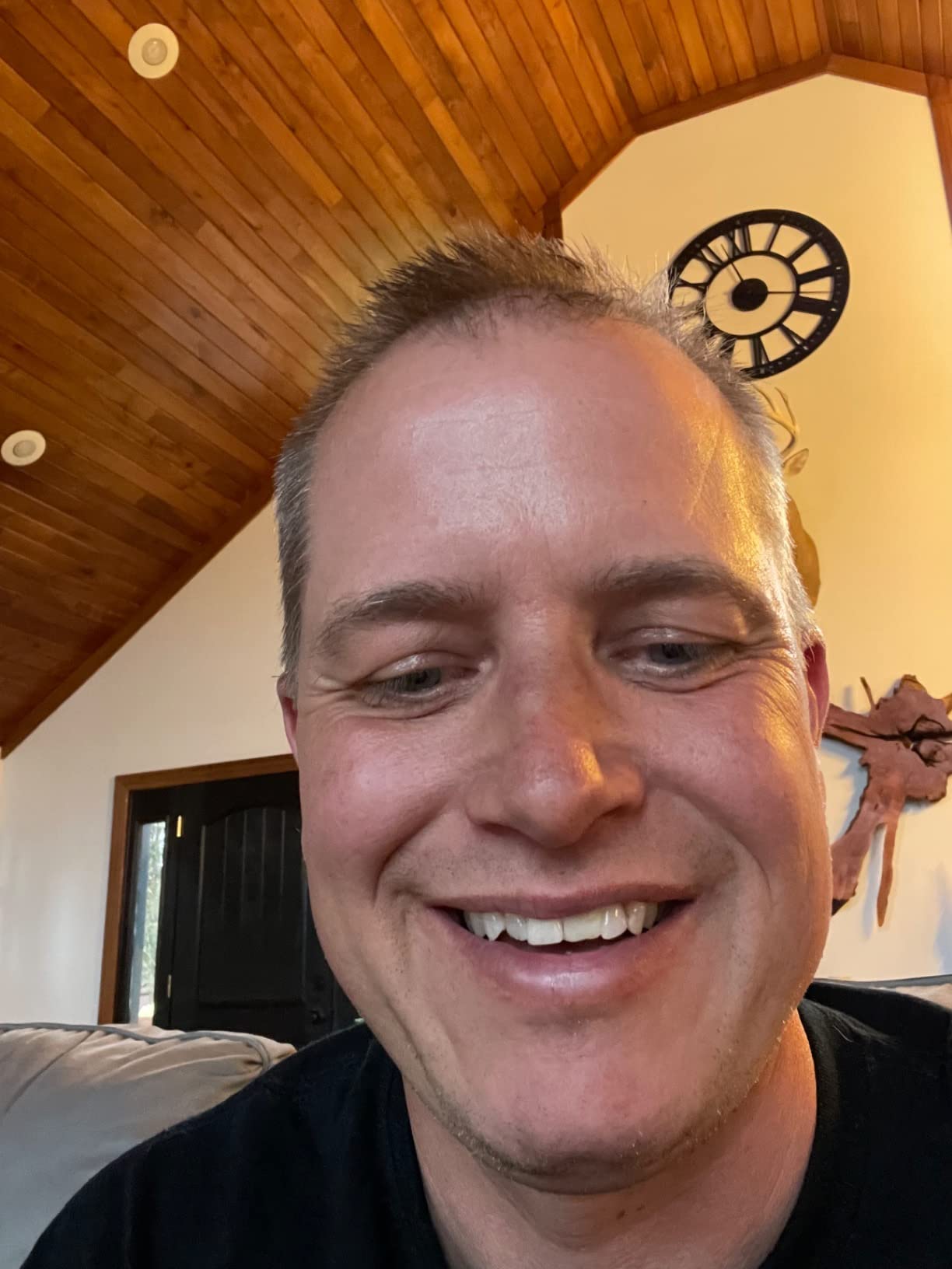 Tooth Repair Granules