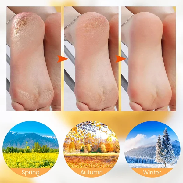 🔥New Sale🔥-Moisturizing Foot Mask Exfoliating Socks