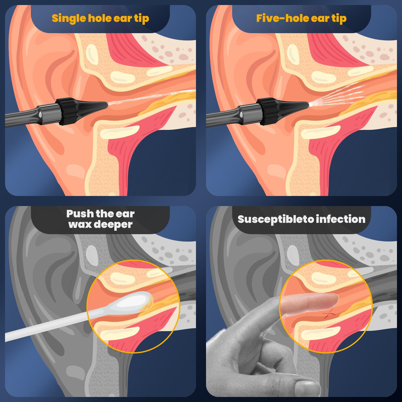 Flush Earwax Remover
