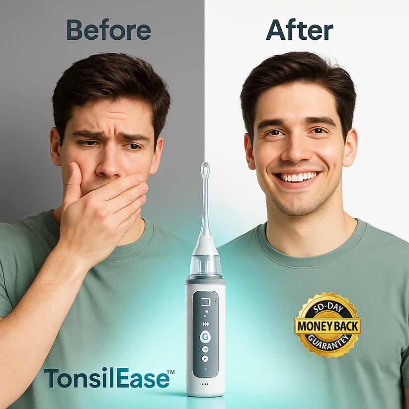 TonsilEase Tonsil Stone Removal Kit