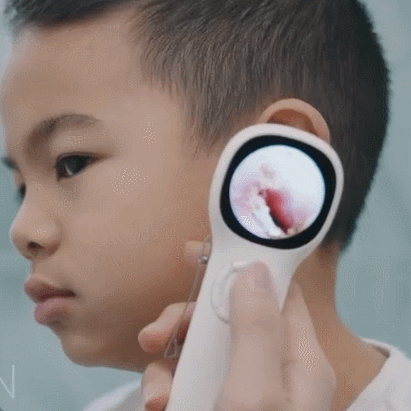 Otoscope Ear Camera with 1.21” Screen Earwax Removal Kit