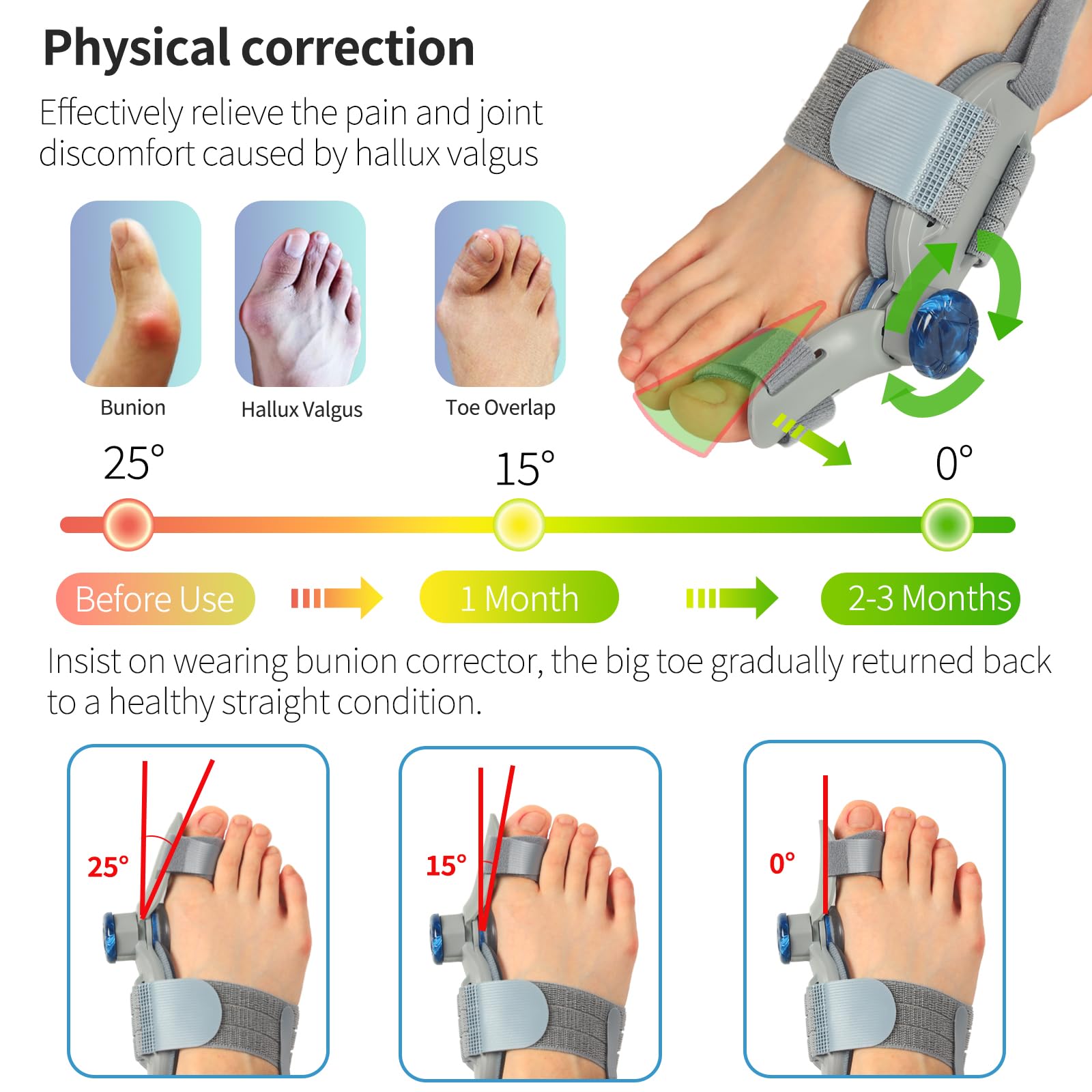 Adjustable hallux valgus corrector