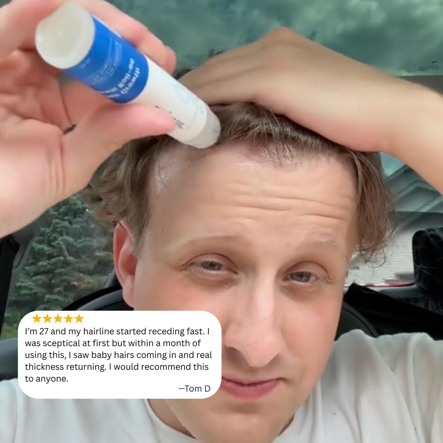 Bodywise Hair Growth Serum Roll On 