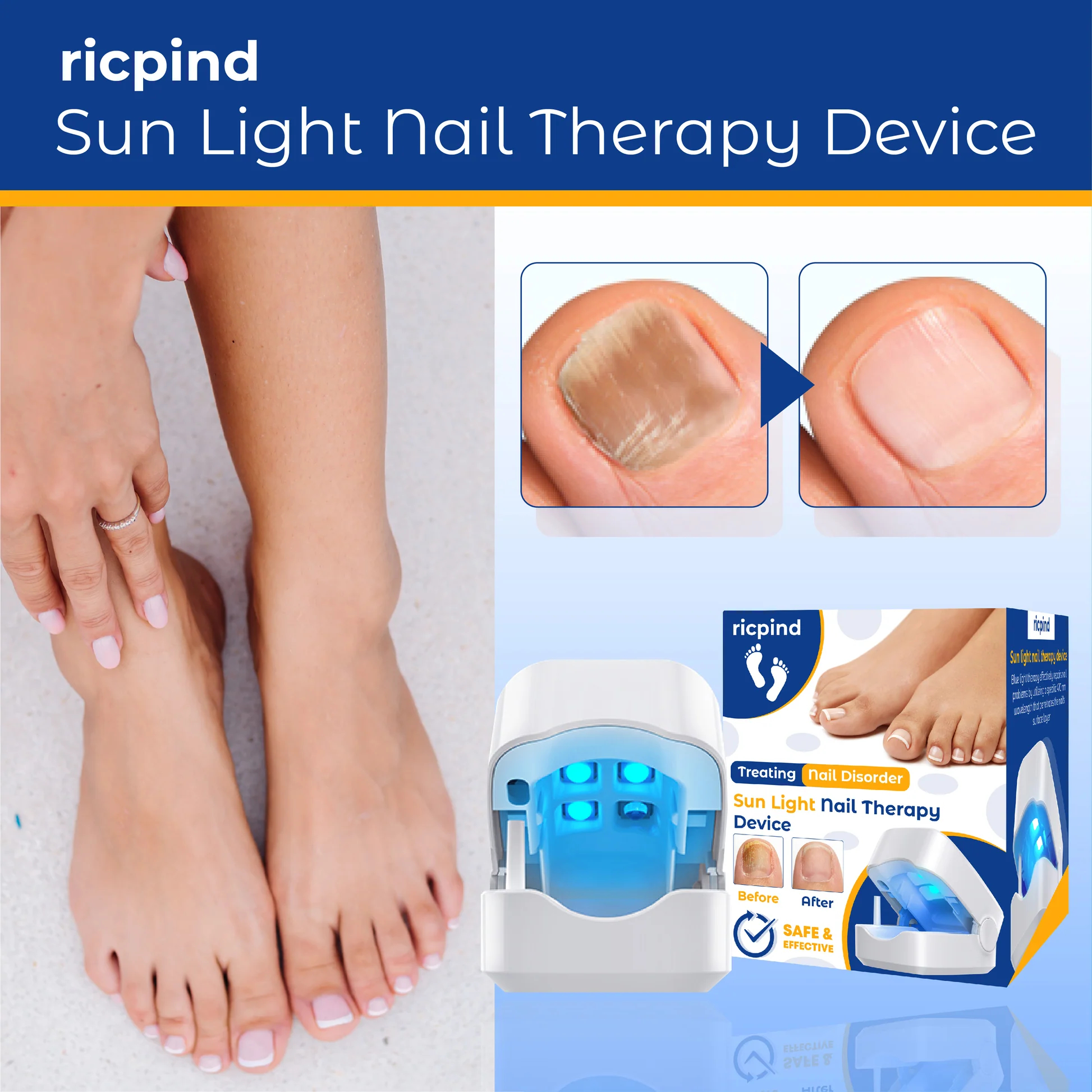 Welnax™ High-Efficiency Light Therapy Device For Toenail Diseases