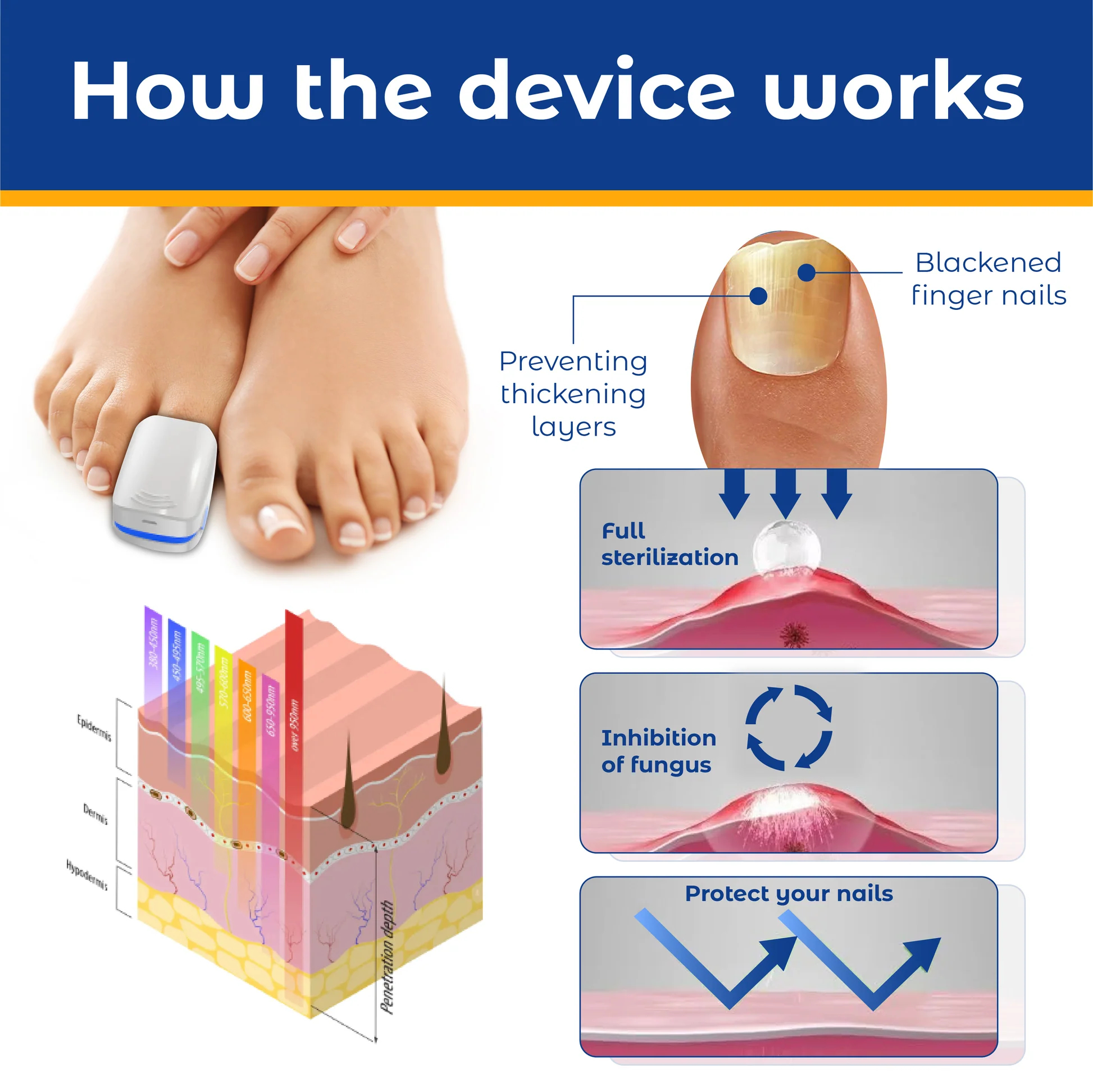 Welnax™ High-Efficiency Light Therapy Device For Toenail Diseases