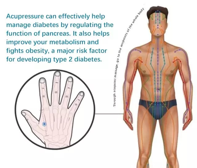 Keillini ™ Hypoglycemic acupoint clip