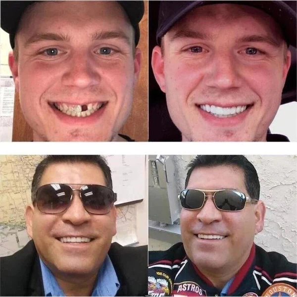 ✨Last day discount-50%Off👨‍⚕Adjustable Snap-On Dentures😁