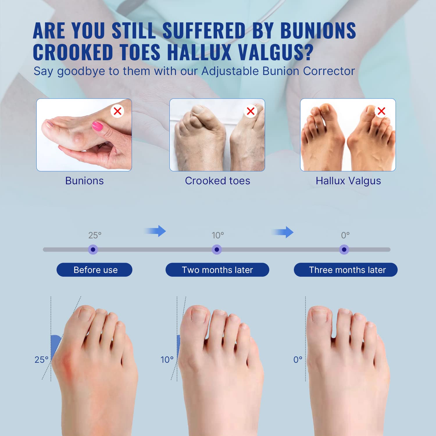 Bunion Correcto