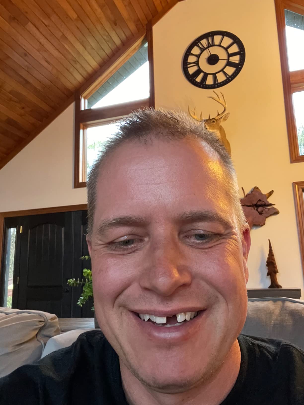 Tooth Repair Granules