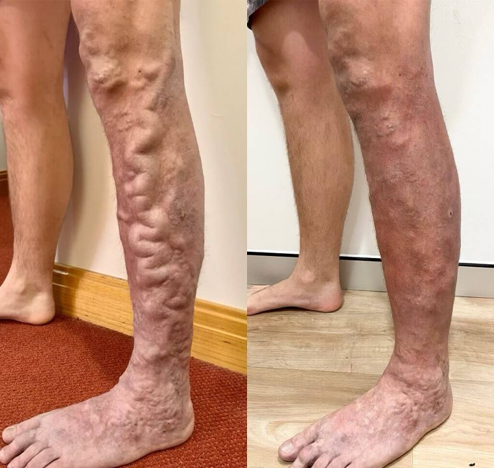 QIAWI&reg; Legs Soothing Cream