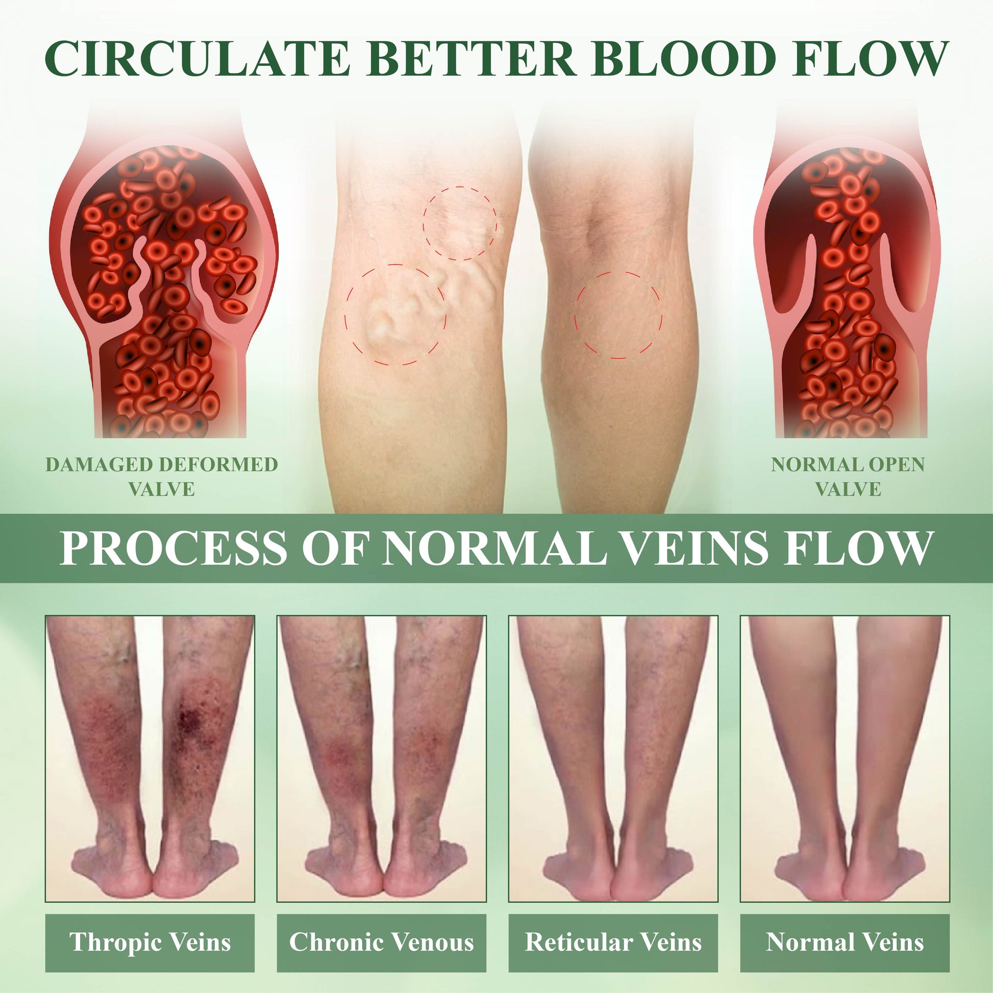 Welnax™ Leg Therapy Edema Cream