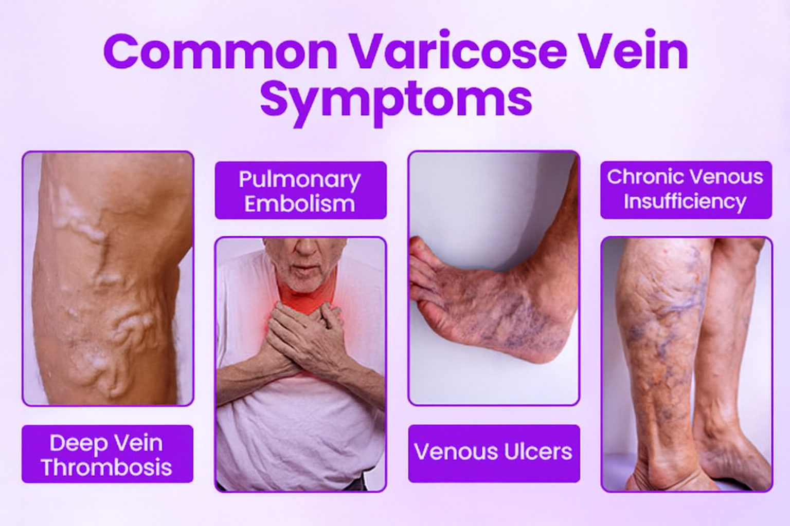 QIAWI&reg; Legs Soothing Cream