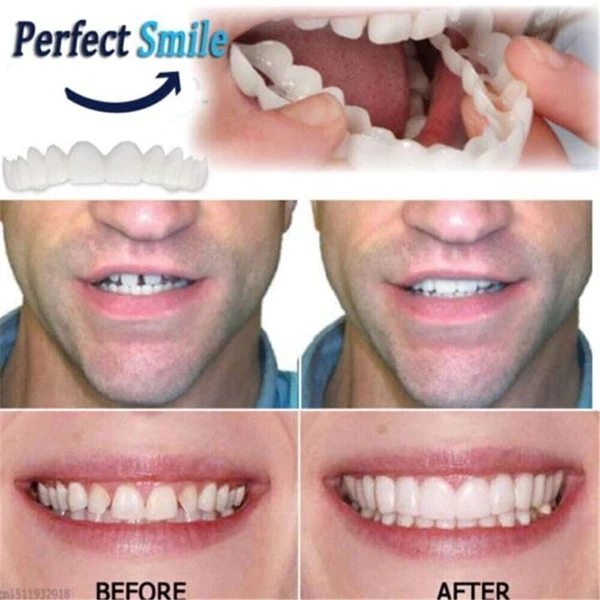 ✨Last day discount-50%Off👨‍⚕Adjustable Snap-On Dentures😁