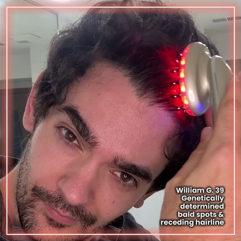 Hair Regrowth Laser Comb- For Lasting Strong & Full Hair