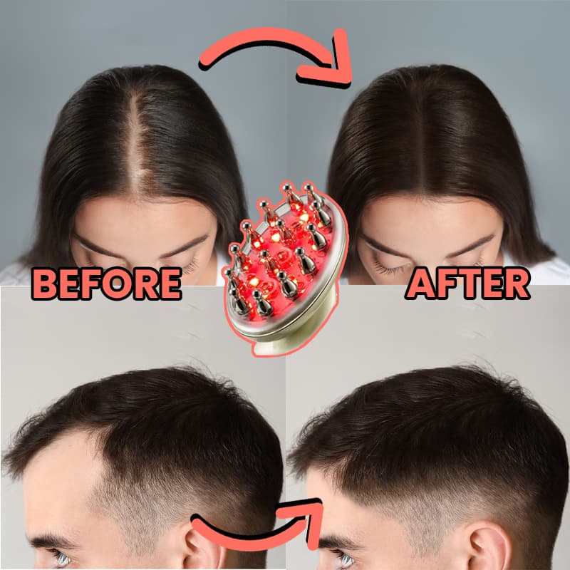 Hair Regrowth Laser Comb- For Lasting Strong & Full Hair