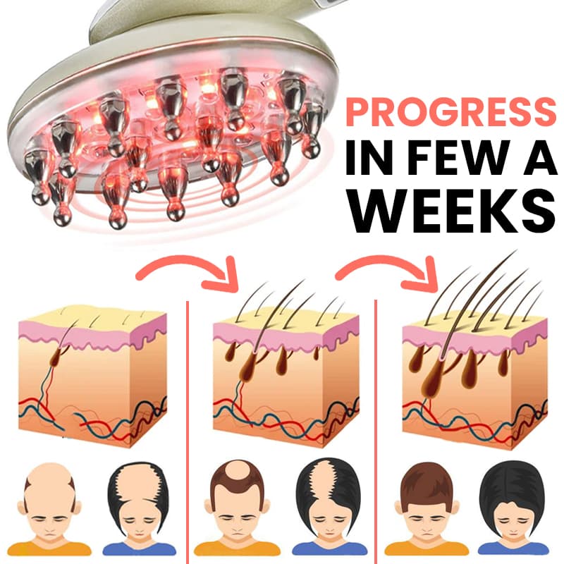 Hair Regrowth Laser Comb- For Lasting Strong & Full Hair