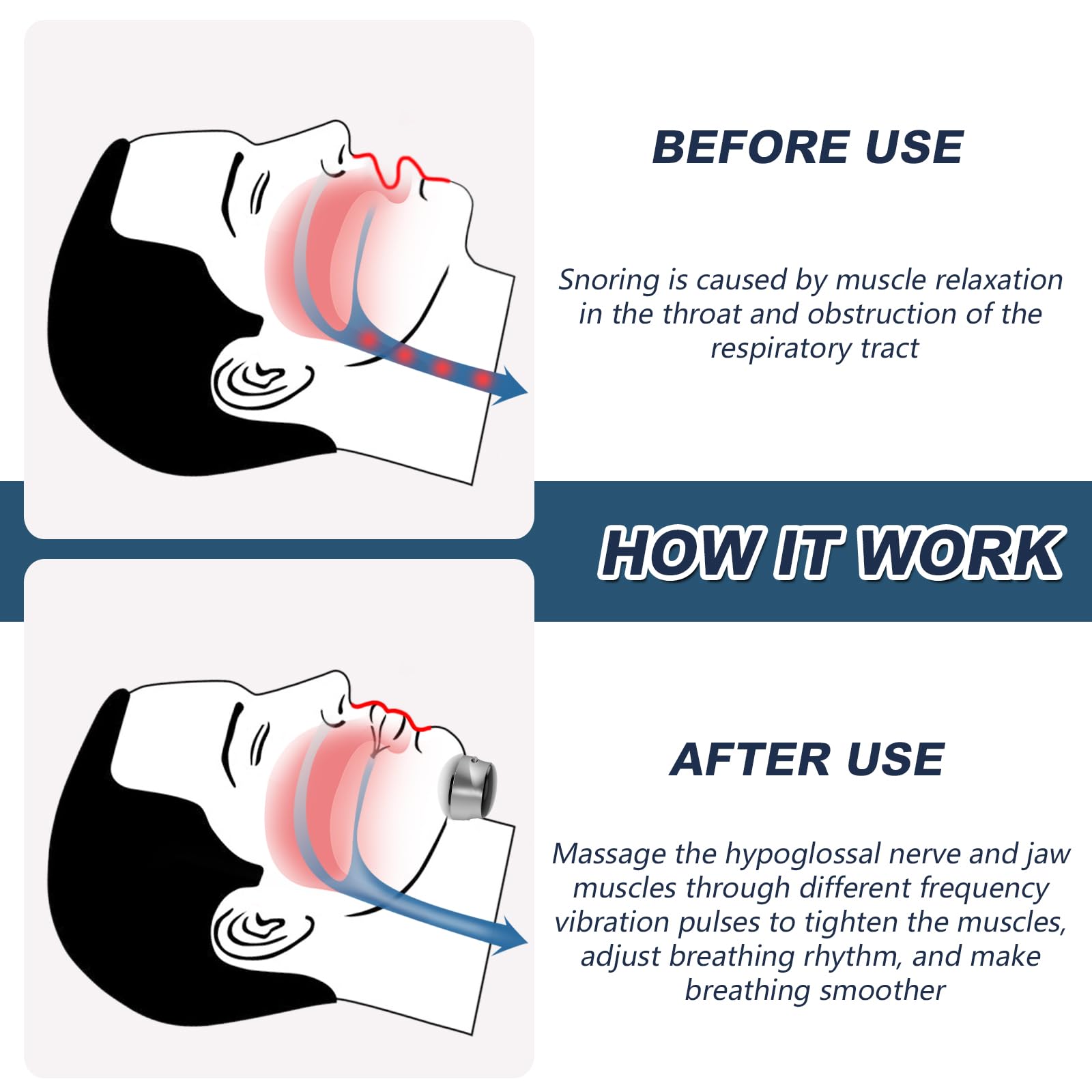 Welnax™ Anti-snore Patch