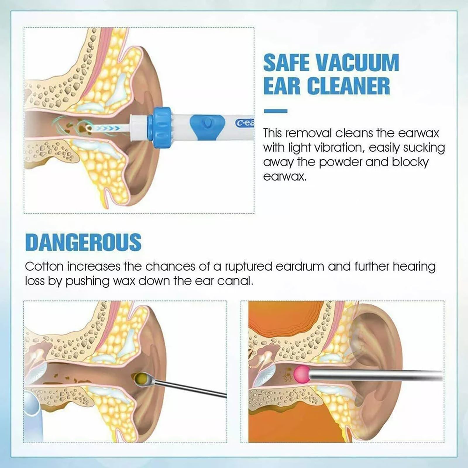 Electric Vacuum Ear Cleaner Suction