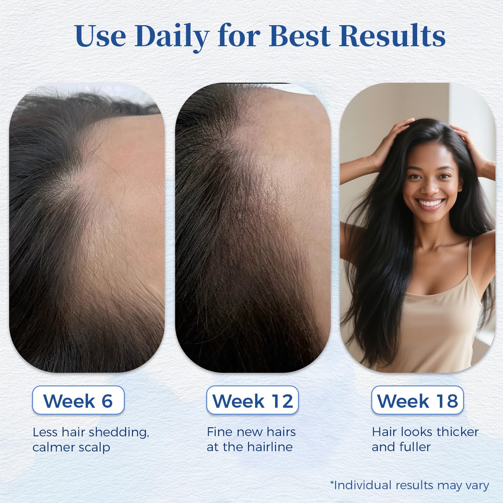 Bodywise Hair Growth Serum Roll On 