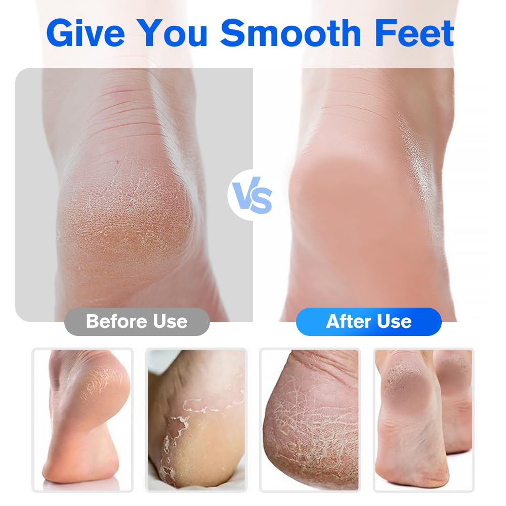  Nano Glass Foot File with Non-Slip Ergonomic Handle