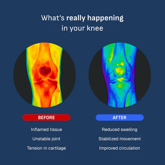 Smart Adjustable Personalized Knee Brace