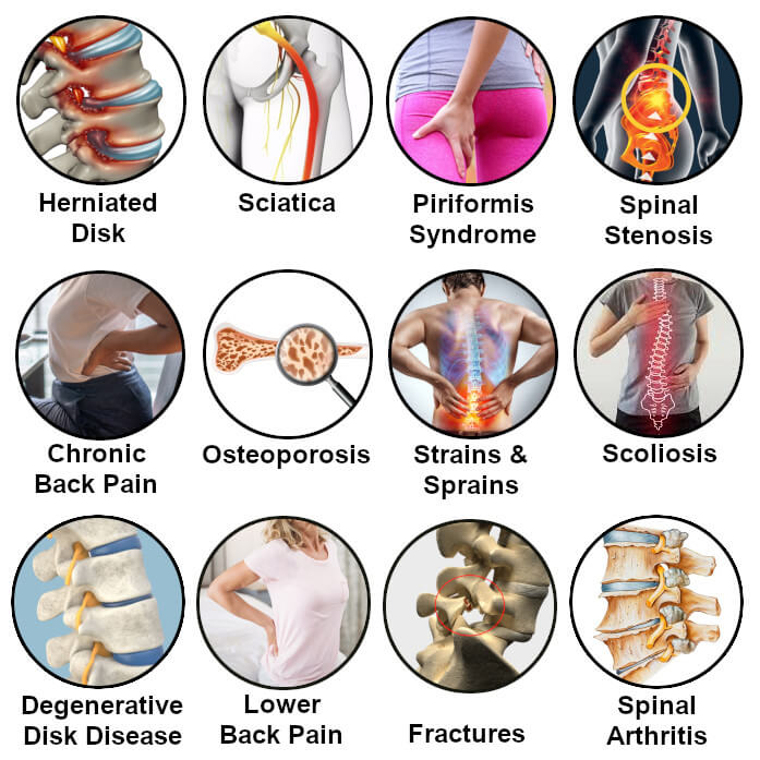 lumbarmate conditions square