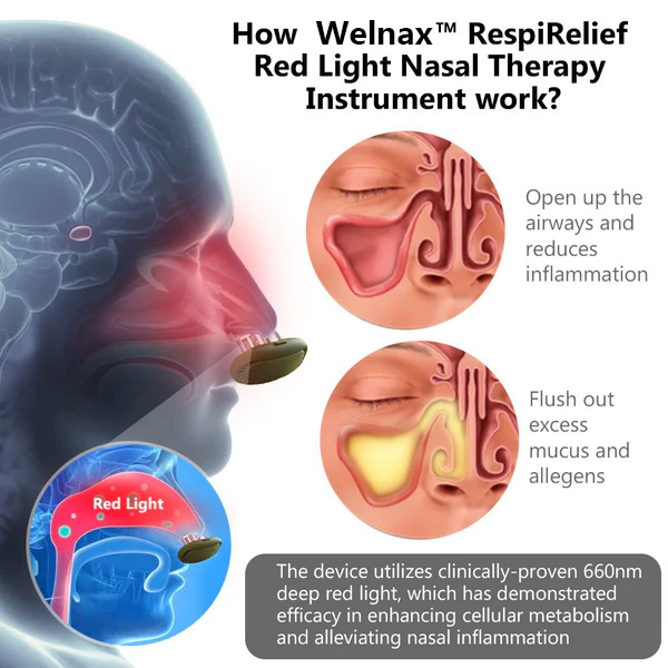 Welnax™ RespiRelief Red Light Nasal Therapy Instrument