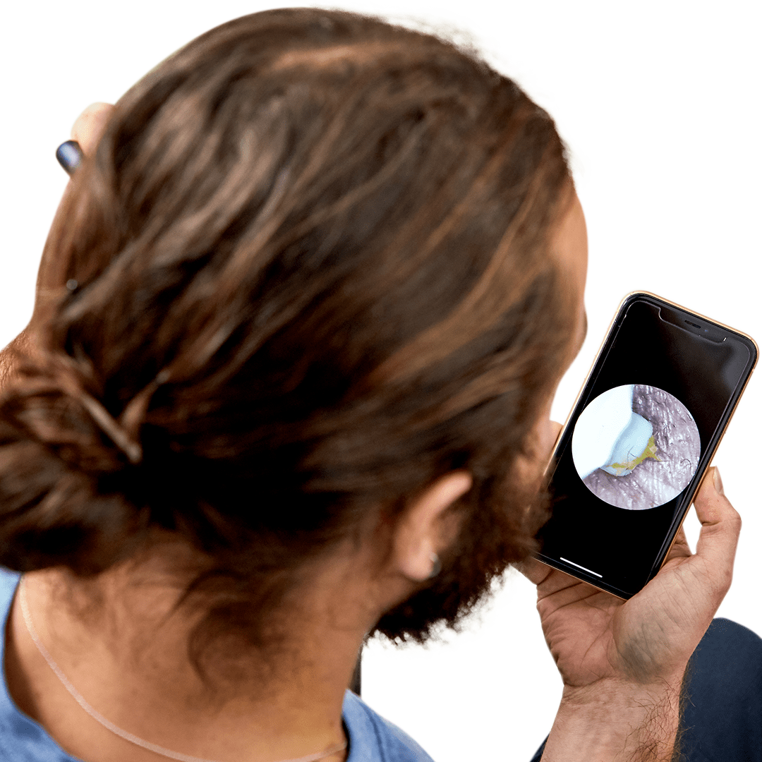 The #1 Smart Ear Wax Remover(Early Black Friday Sale 50% OFF Buy 2 with Free Shipping!)