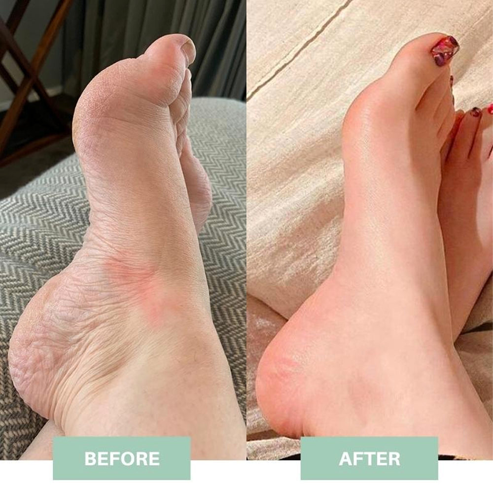 ProFoot™ - EMS Foot Massager