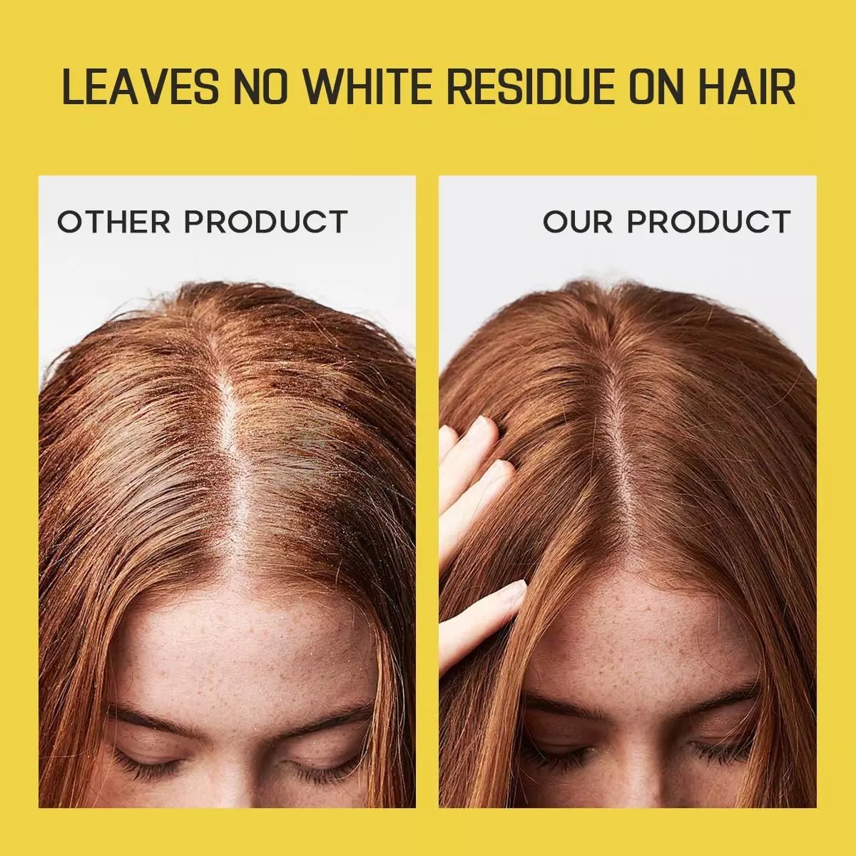 🔥Final Hot Sale-49% OFF🔥 INSTANT FRESH VOLUMZING HAIR DRY SHAMPOO