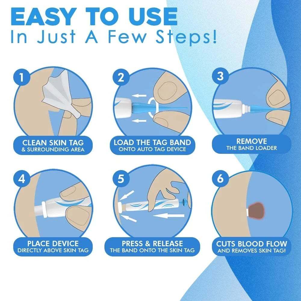 🔥Hot Sale Now 49% OFF - Auto Tag Rapid Removal Kit
