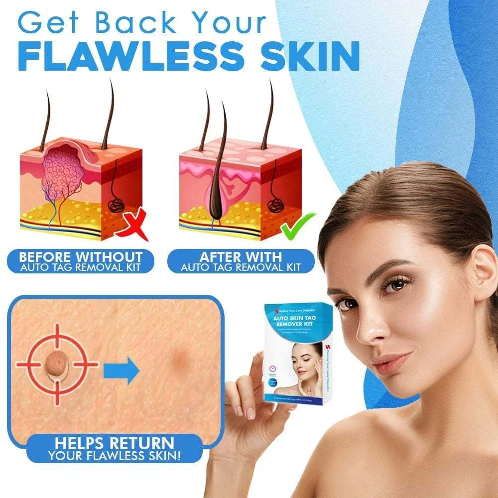 🔥Hot Sale Now 49% OFF - Auto Tag Rapid Removal Kit