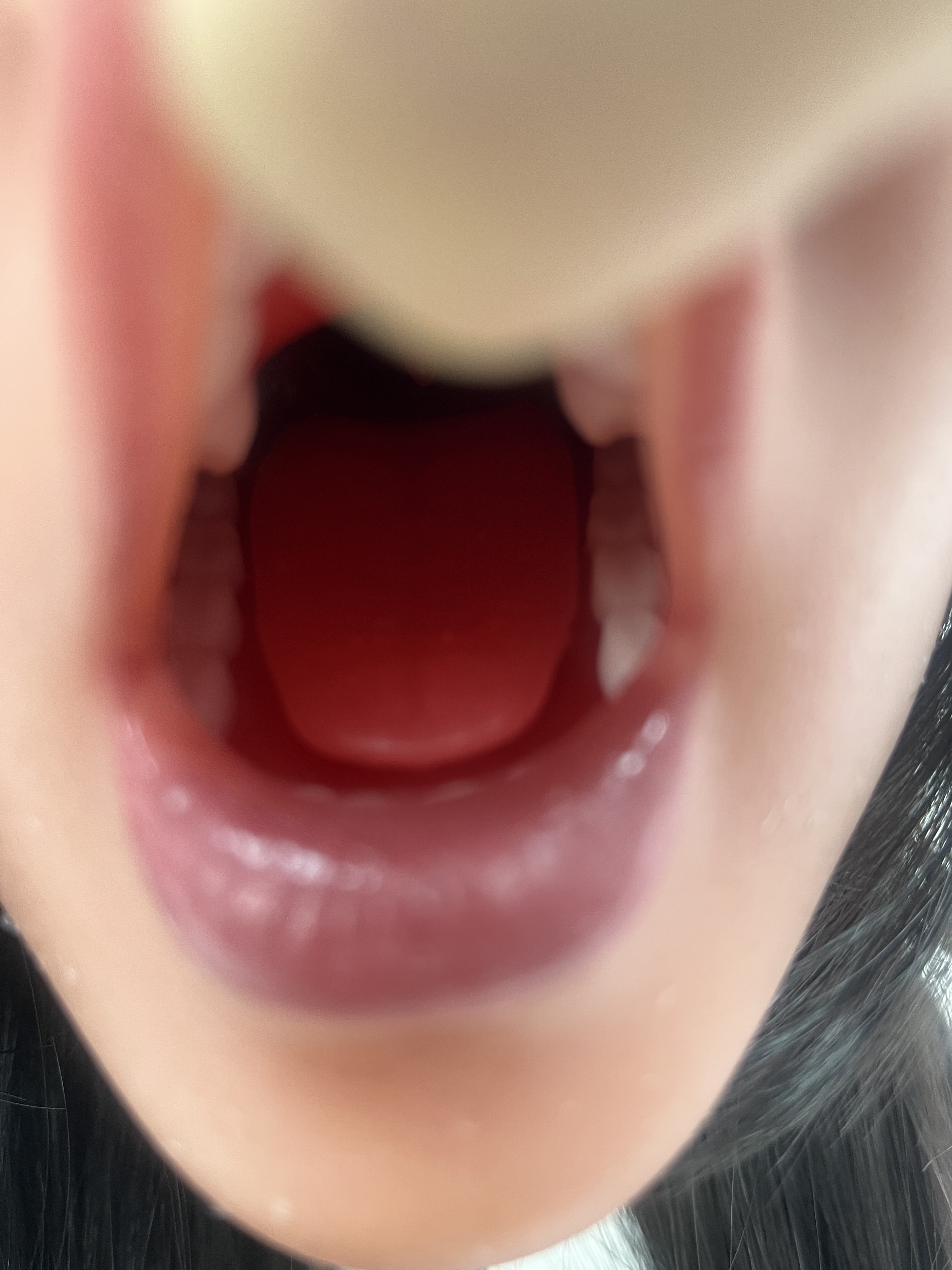 SY | ROS Single Head With Oral Sucking(In Stock US)