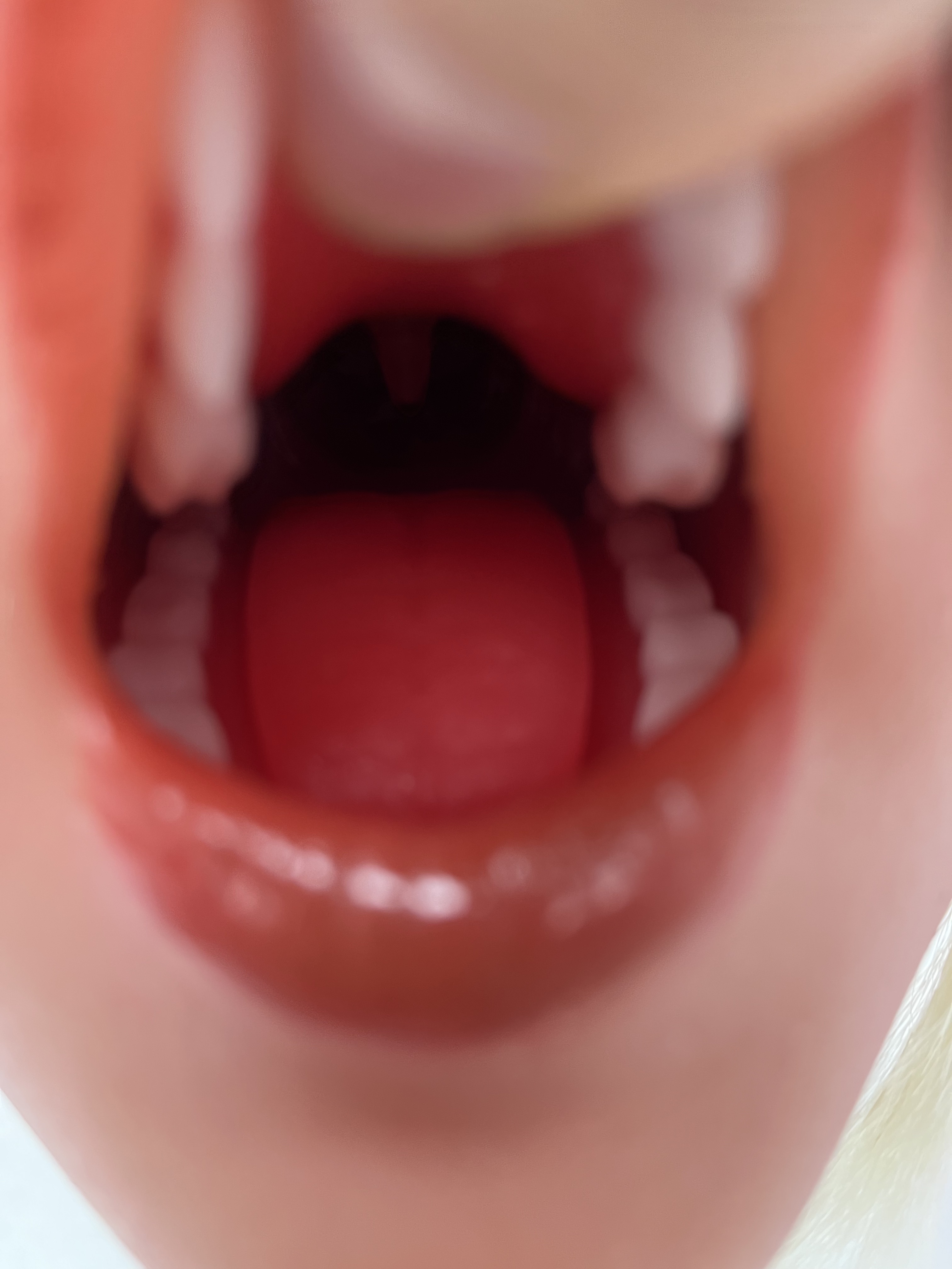 SY | ROS Single Head With Oral Sucking(In Stock US)