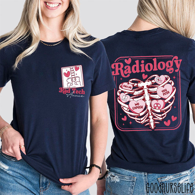 Personalized Rad Life You Pose We Expose Two Sided T-Shirt