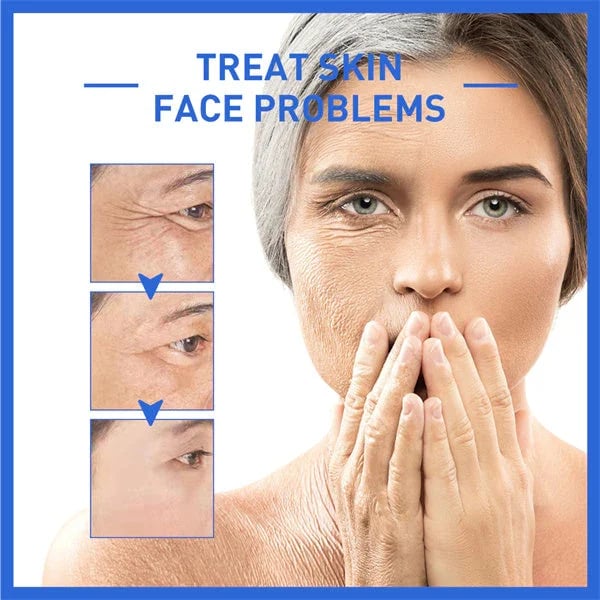 Last Day Promotion 30% OFF--2023 New Collagen Boost Anti-Aging Serum
