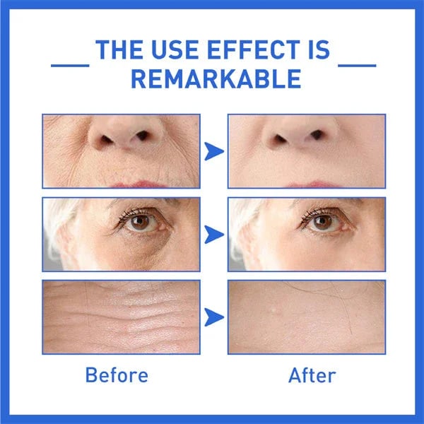 Last Day Promotion 30% OFF--2023 New Collagen Boost Anti-Aging Serum