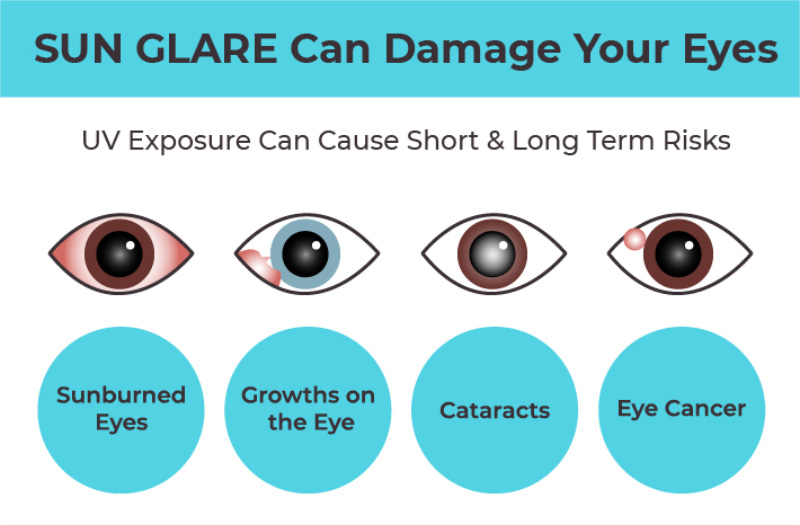 Do Contact Lenses Melt in Heat? Find the Answer Here.-MCLEYE