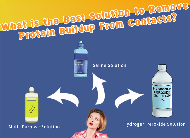 Effortless Solutions Removing Protein Deposits from Contact LensesMCLEYE