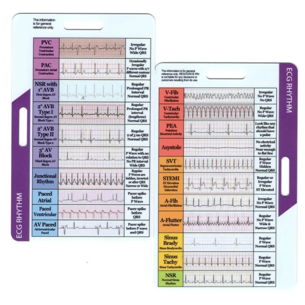 🔥ECG/EKG Rhythm Pocket Card