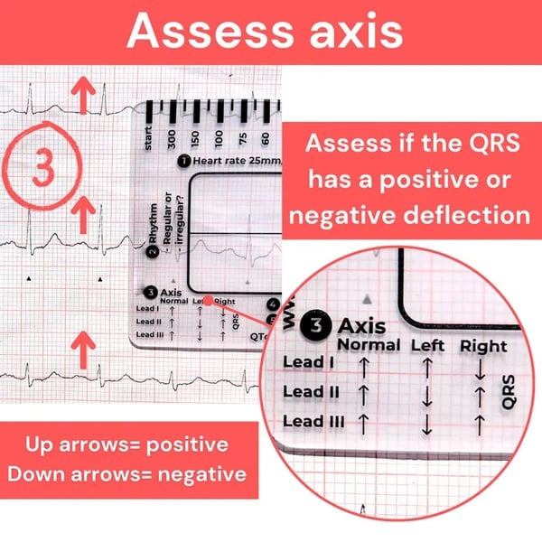🔥ECG/EKG Rhythm Pocket Card