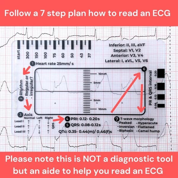 🔥ECG/EKG Rhythm Pocket Card