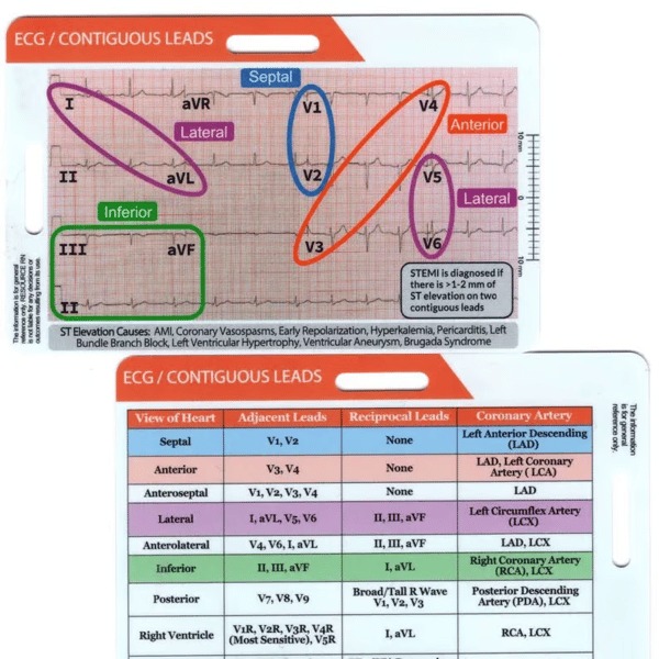 🔥ECG/EKG Rhythm Pocket Card