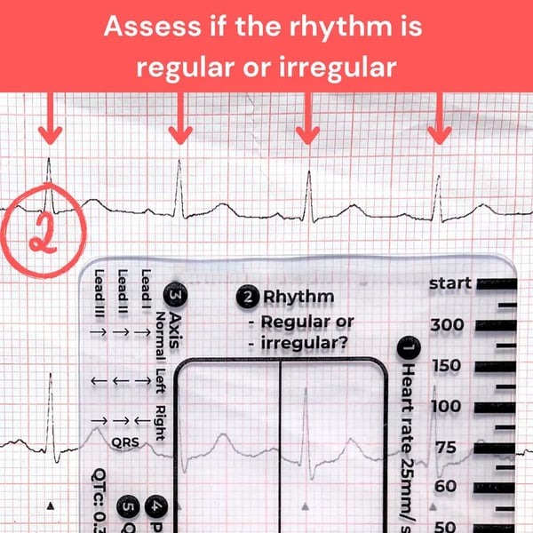 🔥ECG/EKG Rhythm Pocket Card