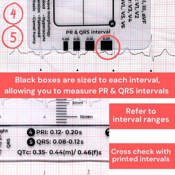 🔥ECG/EKG Rhythm Pocket Card
