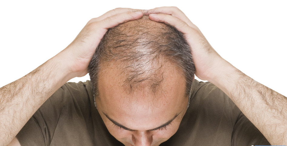 Can AIDEVI NMN Stimulate Hair Growth Long-Term?-AIDEVI