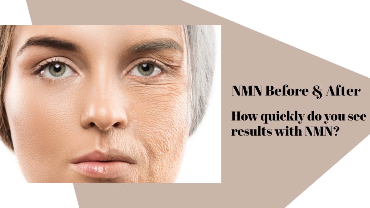 NMN Before and After: How quickly do you see results with NMN?-AIDEVI